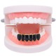 Punk Black Matte Braces Hiphop Grillz Gold Plated Dentures Set Teeth Jewelry