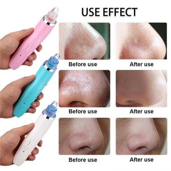 XD-5002 Face Facial Cleansing DC5V 850mA USB Electric Nose Pore Cleanser Cleaner Vacuum Beauty Machine Blackhead Zit Acne Remover Tool