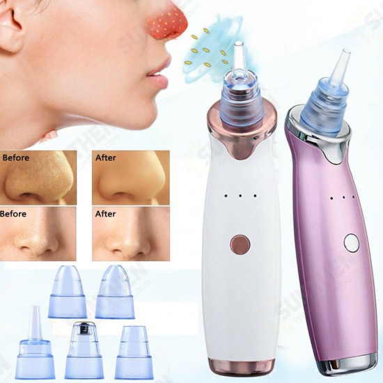 Electric Facial Pore Acne Blackhead Remover Vacuum Suction Diamond Dermabrasion Beauty Machine