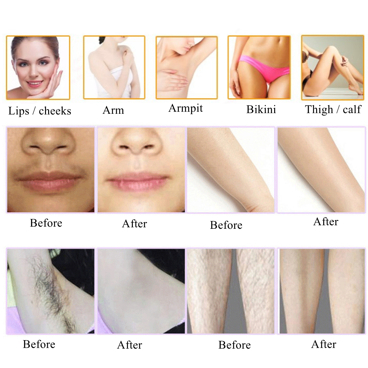 Laser-IPL-Permanent-Hair-Removal-Bikini-Face-Leg-Arm-Body-Care-Remover-Machine-1259642-6